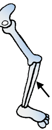 14.png